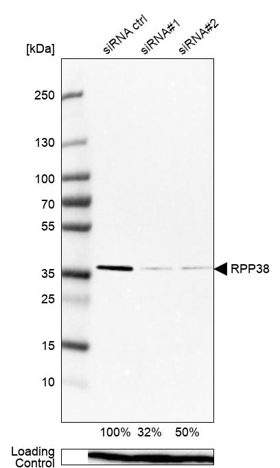 Atlas Antibodies Anti-RPP38 Antibody