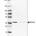 Atlas Antibodies Anti-RPP38 Antibody