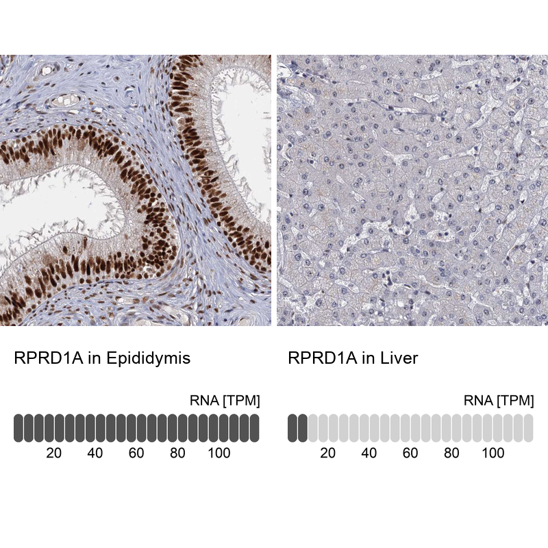 Atlas Antibodies Anti-RPRD1A Antibody