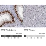 Atlas Antibodies Anti-RPRD1A Antibody