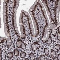 Atlas Antibodies Anti-RPRD1B Antibody