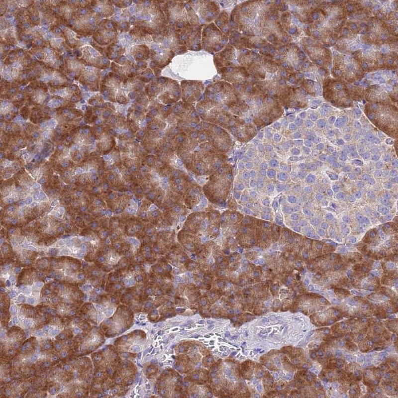Atlas Antibodies Anti-RPS10 Antibody