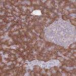 Atlas Antibodies Anti-RPS10 Antibody
