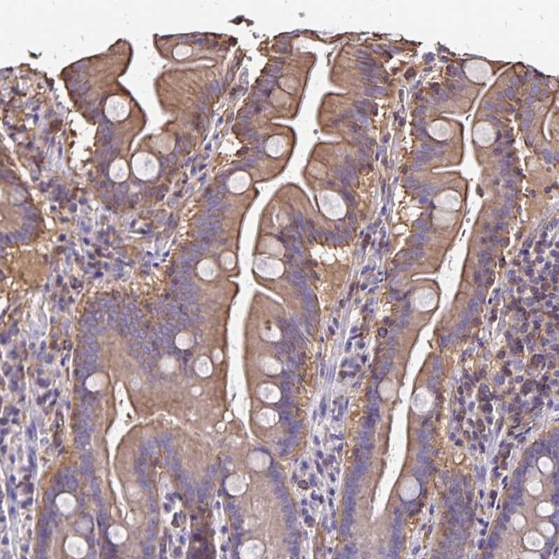 Atlas Antibodies Anti-RPRML Antibody
