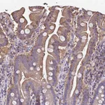 Atlas Antibodies Anti-RPRML Antibody