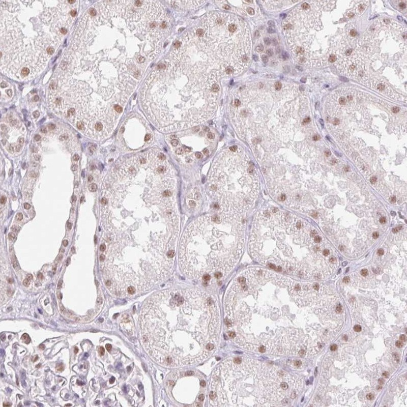 Atlas Antibodies Anti-RPRD1B Antibody