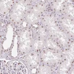 Atlas Antibodies Anti-RPRD1B Antibody