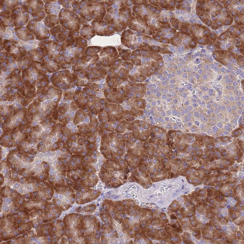 Atlas Antibodies Anti-RPS10 Antibody