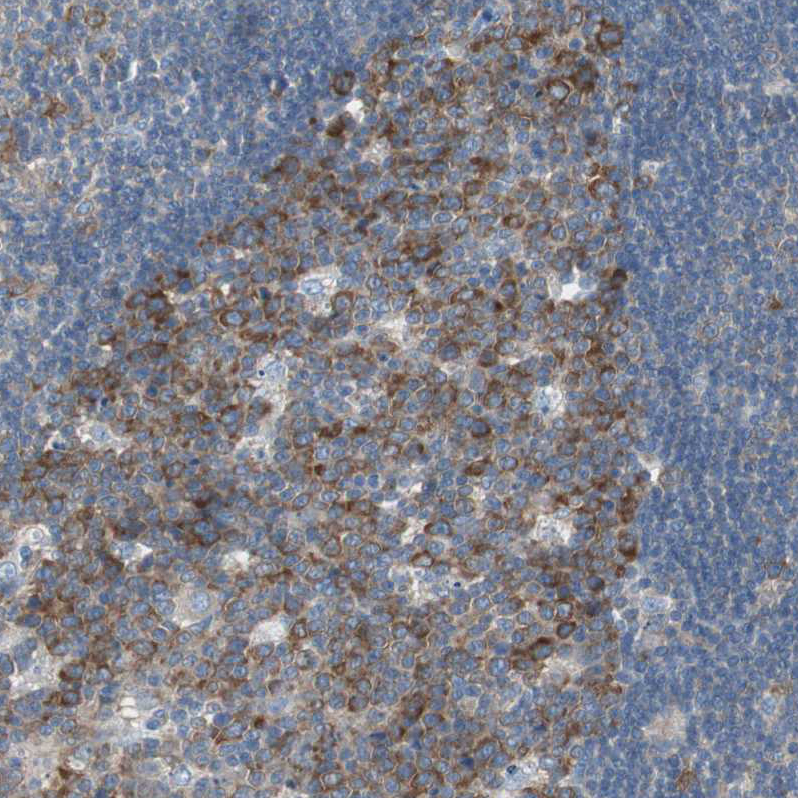 Atlas Antibodies Anti-RPS12 Antibody