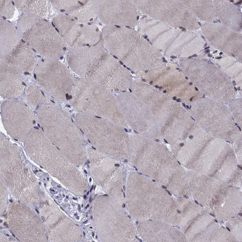 Atlas Antibodies Anti-RPRD2 Antibody