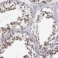 Atlas Antibodies Anti-RPRD1B Antibody