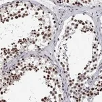 Atlas Antibodies Anti-RPRD1B Antibody