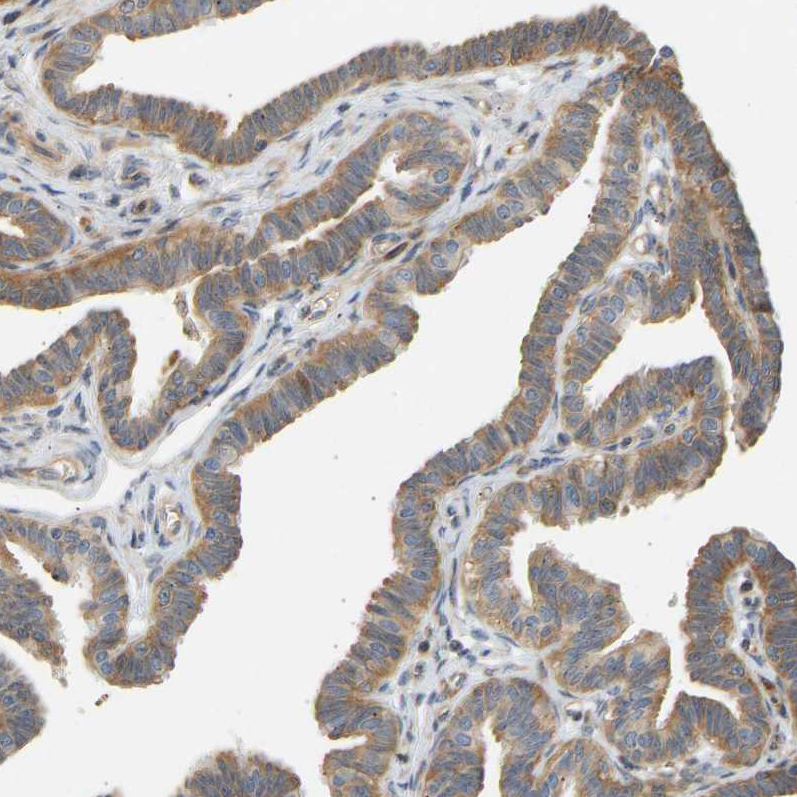 Atlas Antibodies Anti-RPS14 Antibody