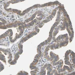 Atlas Antibodies Anti-RPS14 Antibody
