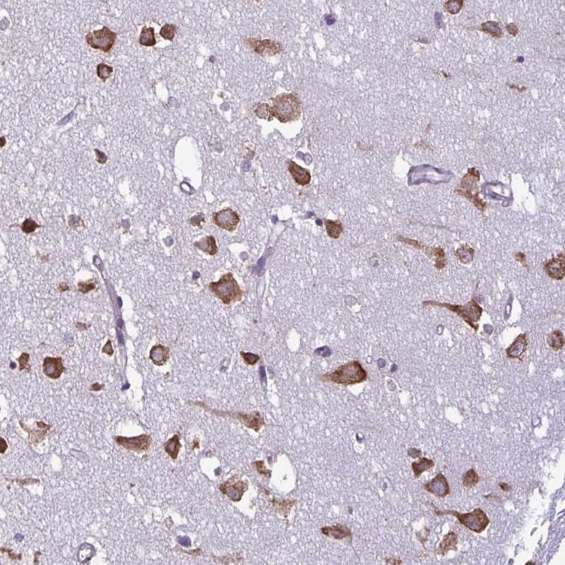 Atlas Antibodies Anti-RPS16 Antibody