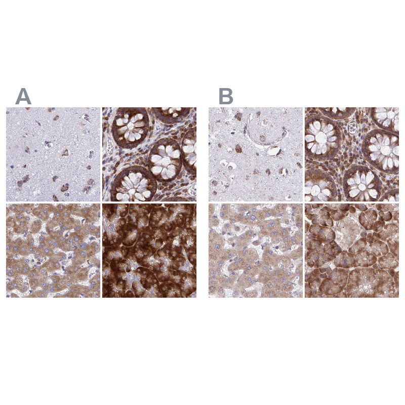 Atlas Antibodies Anti-RPS15 Antibody