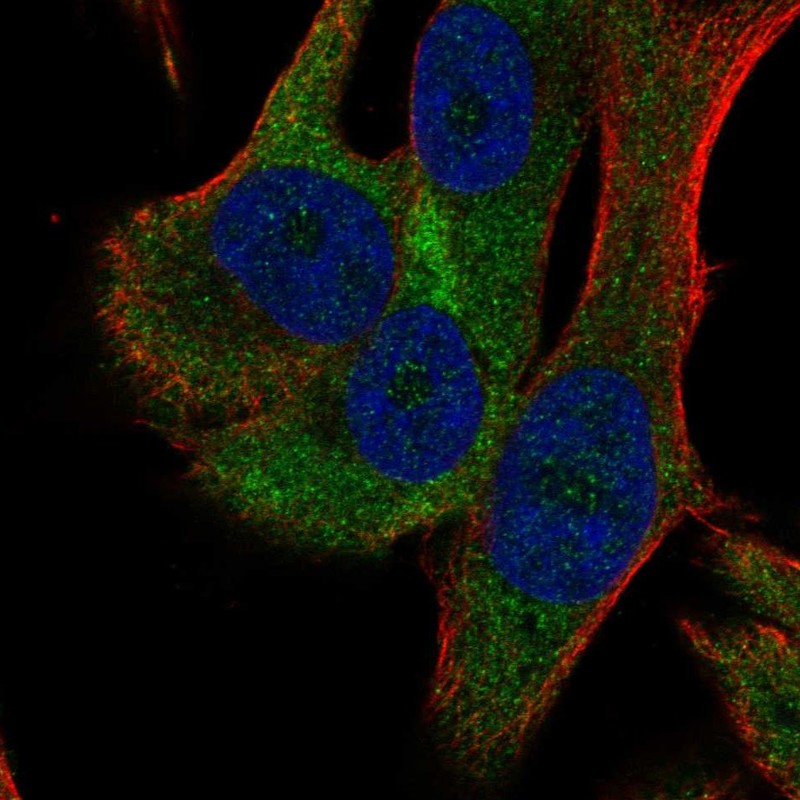 Atlas Antibodies Anti-RPS18 Antibody