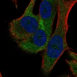 Atlas Antibodies Anti-RPS18 Antibody