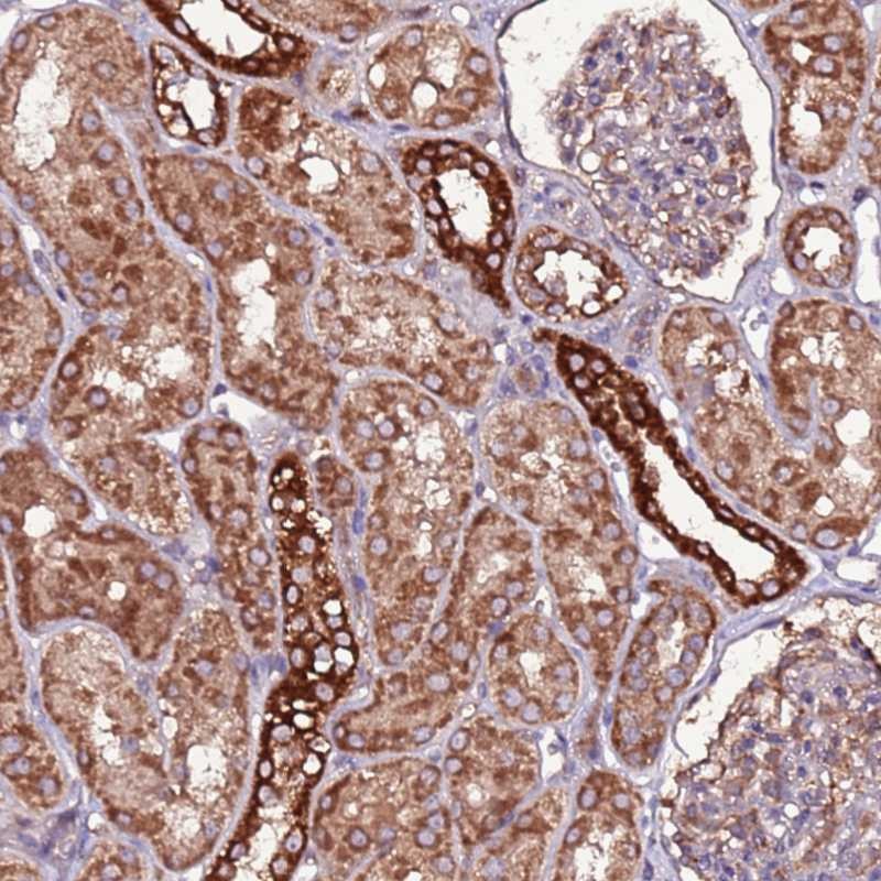 Atlas Antibodies Anti-RPS15A Antibody