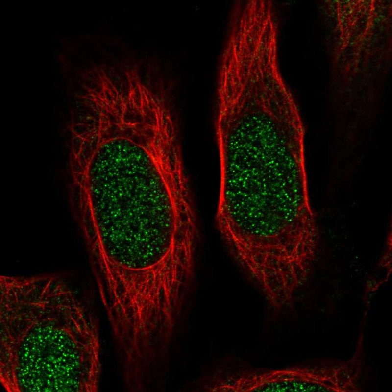 Atlas Antibodies Anti-RPS19 Antibody