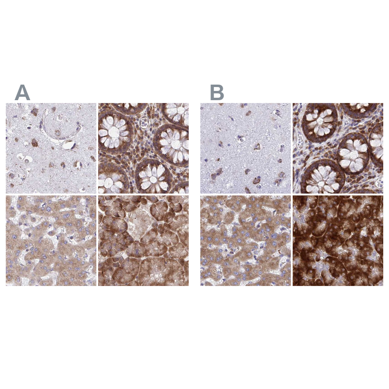 Atlas Antibodies Anti-RPS15 Antibody