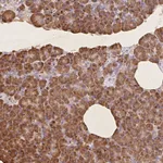 Atlas Antibodies Anti-RPS17 Antibody