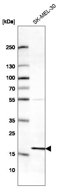Atlas Antibodies Anti-RPS18 Antibody