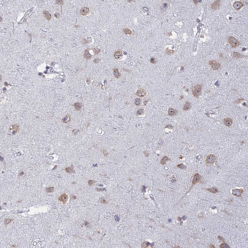 Atlas Antibodies Anti-RPS19BP1 Antibody