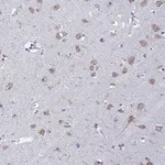 Atlas Antibodies Anti-RPS19BP1 Antibody