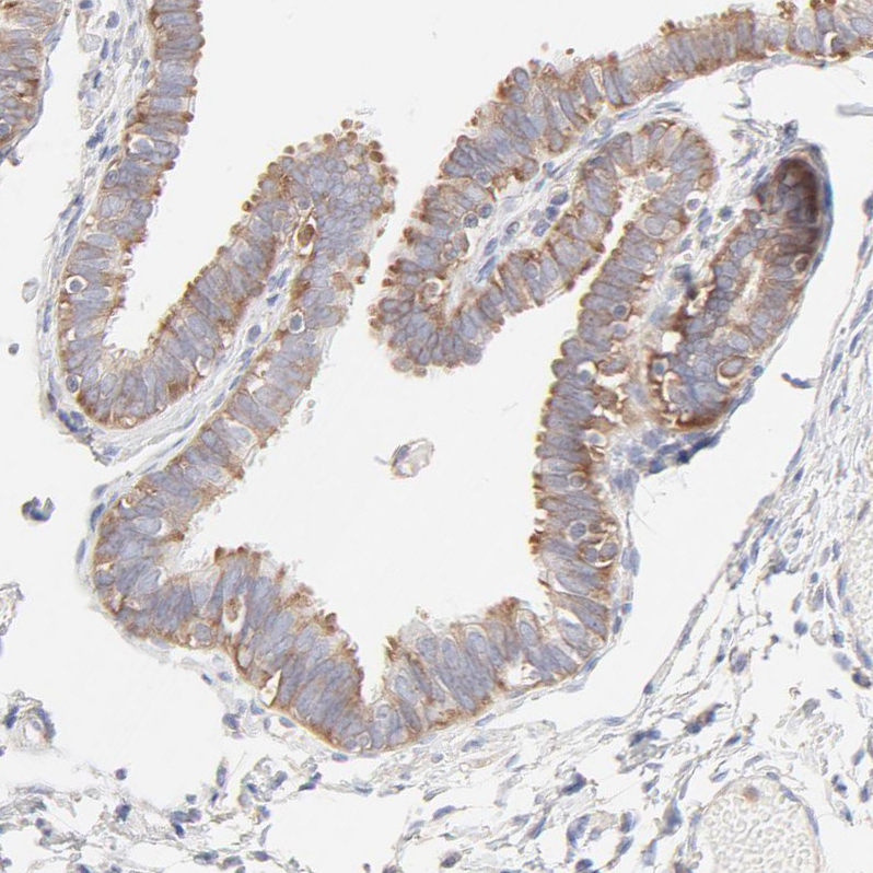 Atlas Antibodies Anti-RPS21 Antibody