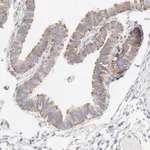 Atlas Antibodies Anti-RPS21 Antibody