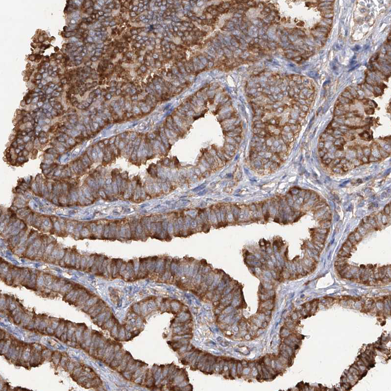 Atlas Antibodies Anti-RPS25 Antibody