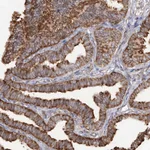 Atlas Antibodies Anti-RPS25 Antibody