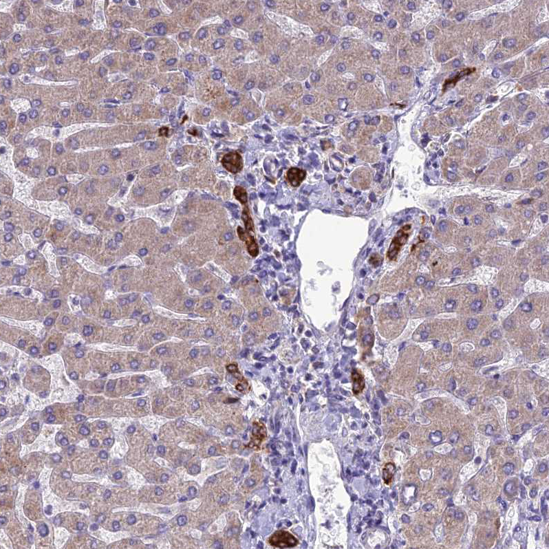 Atlas Antibodies Anti-RPS26 Antibody