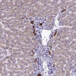 Atlas Antibodies Anti-RPS26 Antibody