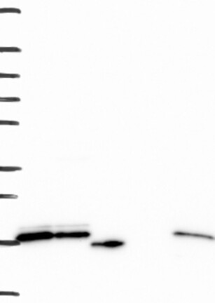 Atlas Antibodies Anti-RPS24 Antibody