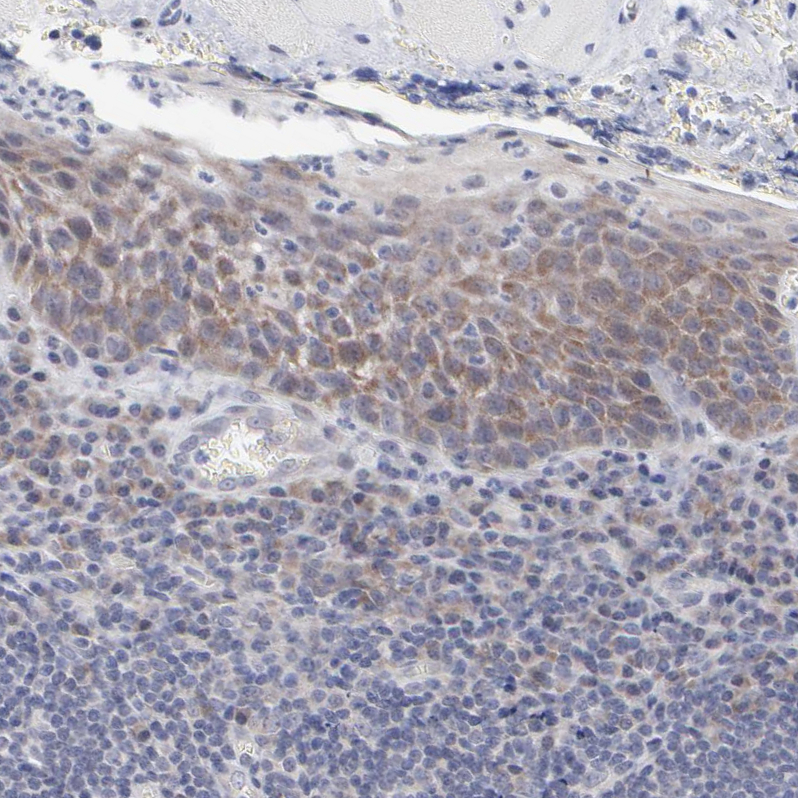 Atlas Antibodies Anti-RPS24 Antibody