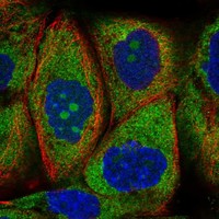Atlas Antibodies Anti-RPS25 Antibody