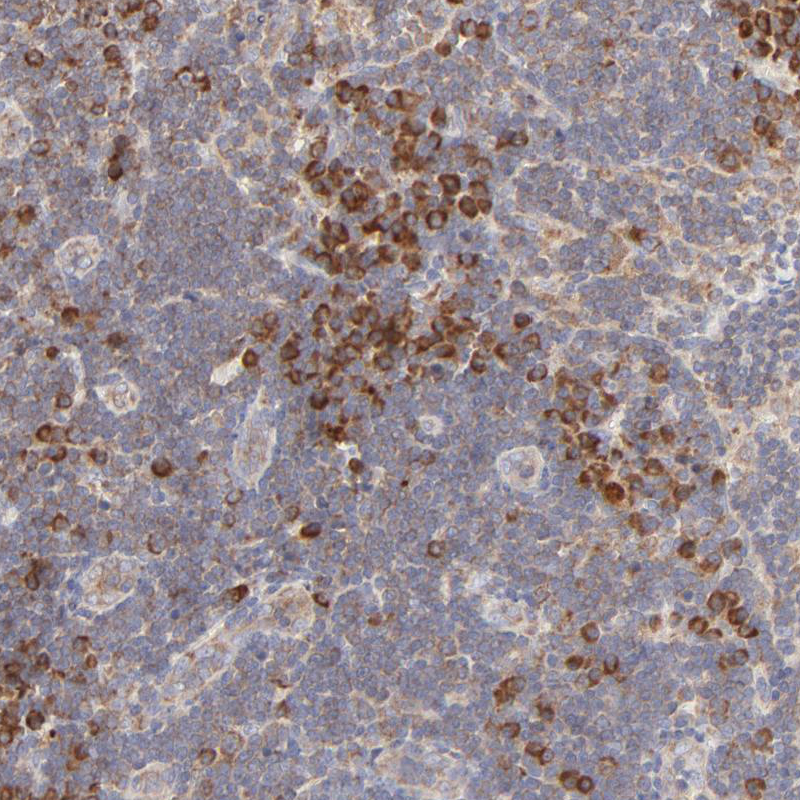 Atlas Antibodies Anti-RPS20 Antibody