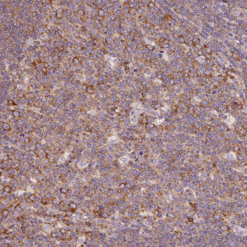 Atlas Antibodies Anti-RPS23 Antibody