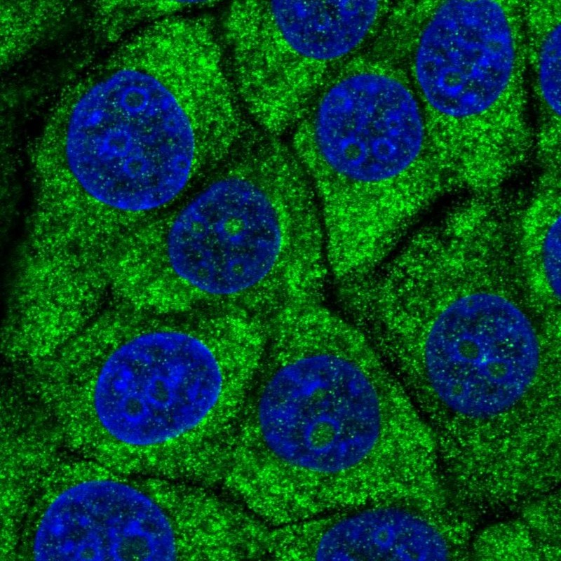 Atlas Antibodies Anti-RPS27A Antibody