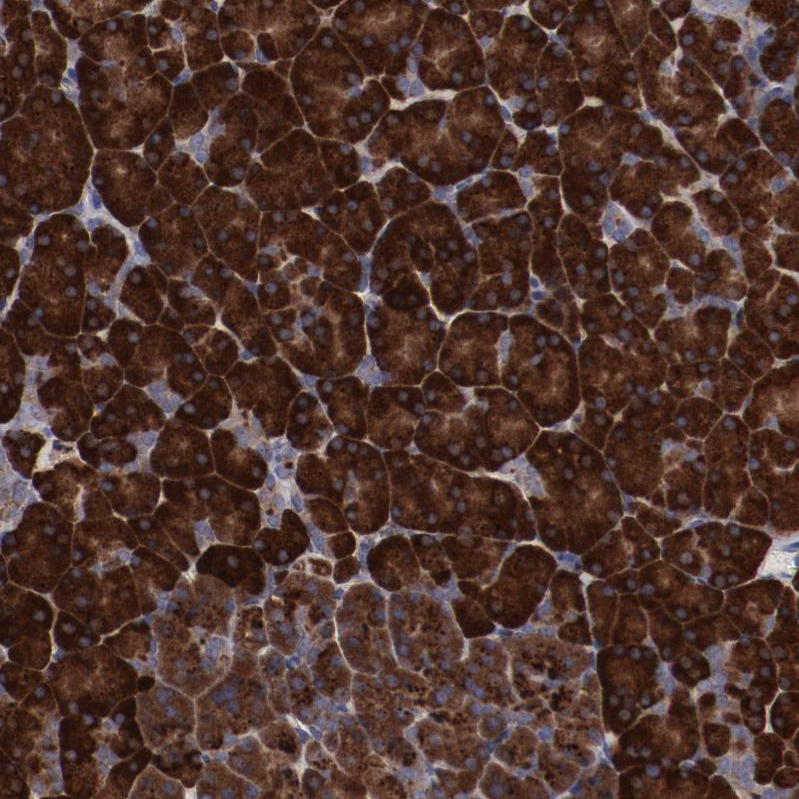 Atlas Antibodies Anti-RPS4X Antibody