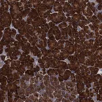 Atlas Antibodies Anti-RPS4X Antibody