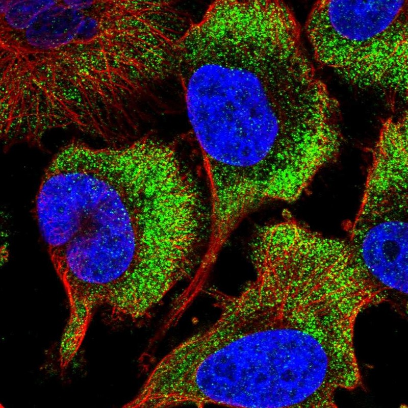 Atlas Antibodies Anti-RPS26 Antibody