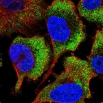 Atlas Antibodies Anti-RPS26 Antibody