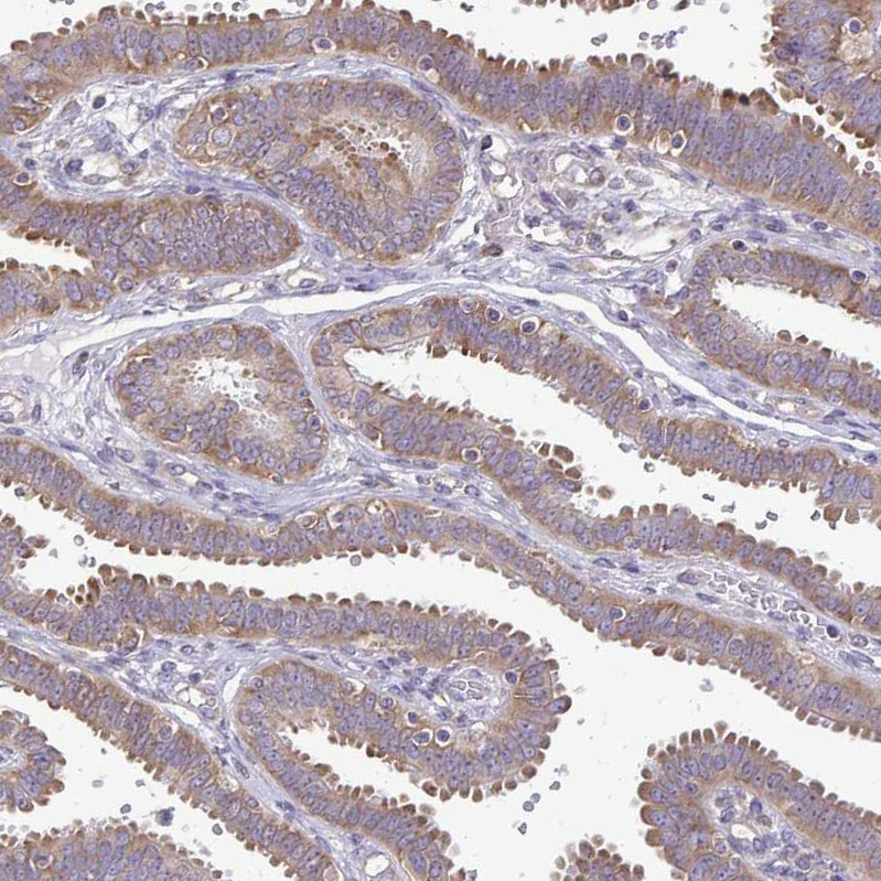 Atlas Antibodies Anti-RPS3 Antibody