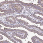 Atlas Antibodies Anti-RPS3 Antibody
