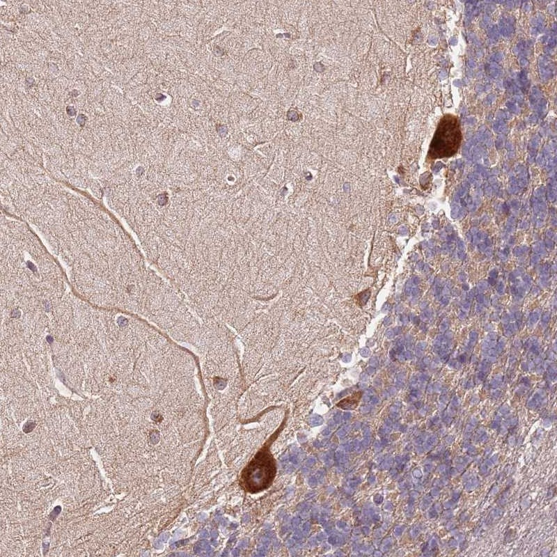 Atlas Antibodies Anti-RPS3A Antibody