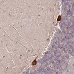 Atlas Antibodies Anti-RPS3A Antibody