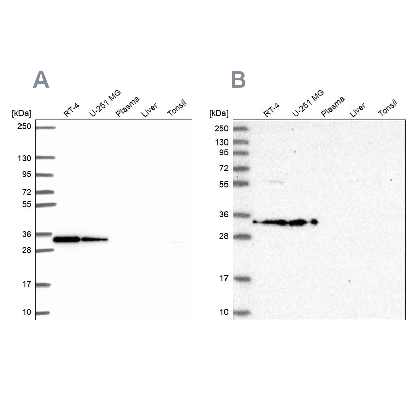 Atlas Antibodies Anti-RPS3A Antibody